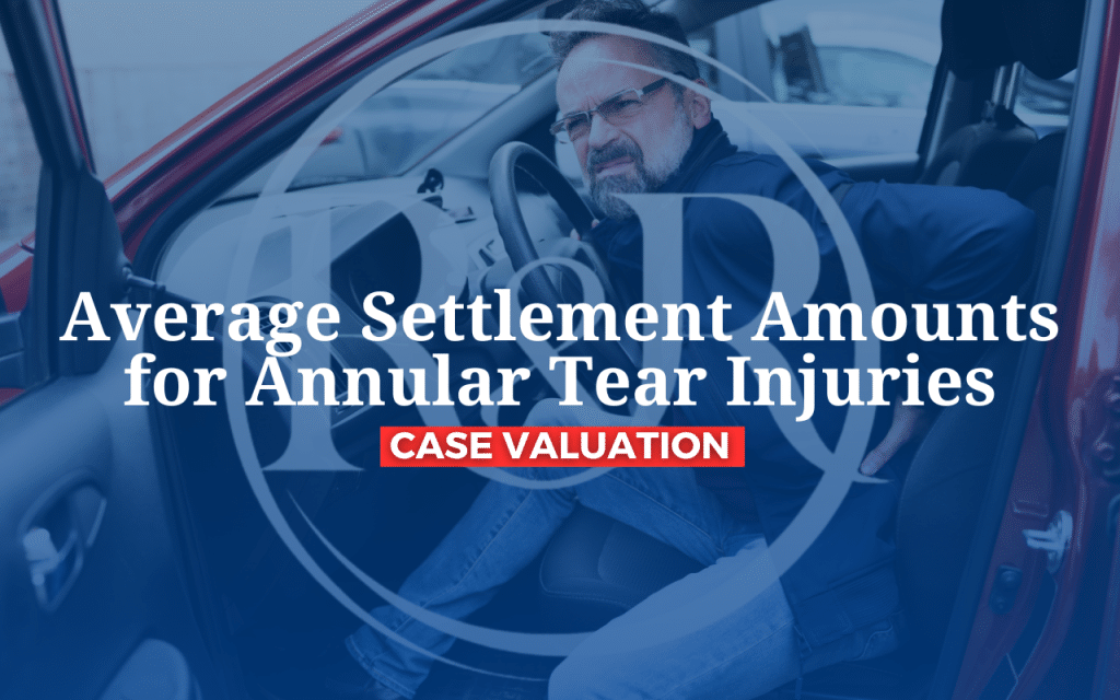 Average Settlement Amounts for Annular Tear Injuries