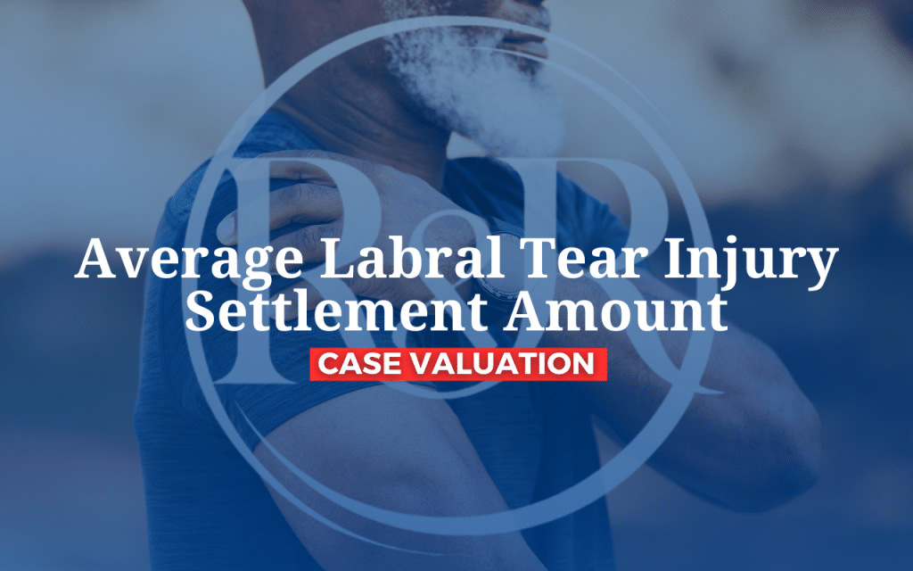 Average Labral Tear Injury Settlement Amount