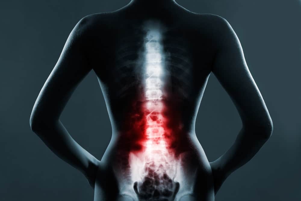 Back Injuries After an Accident - Rosenberg & Rodriguez, PLLC