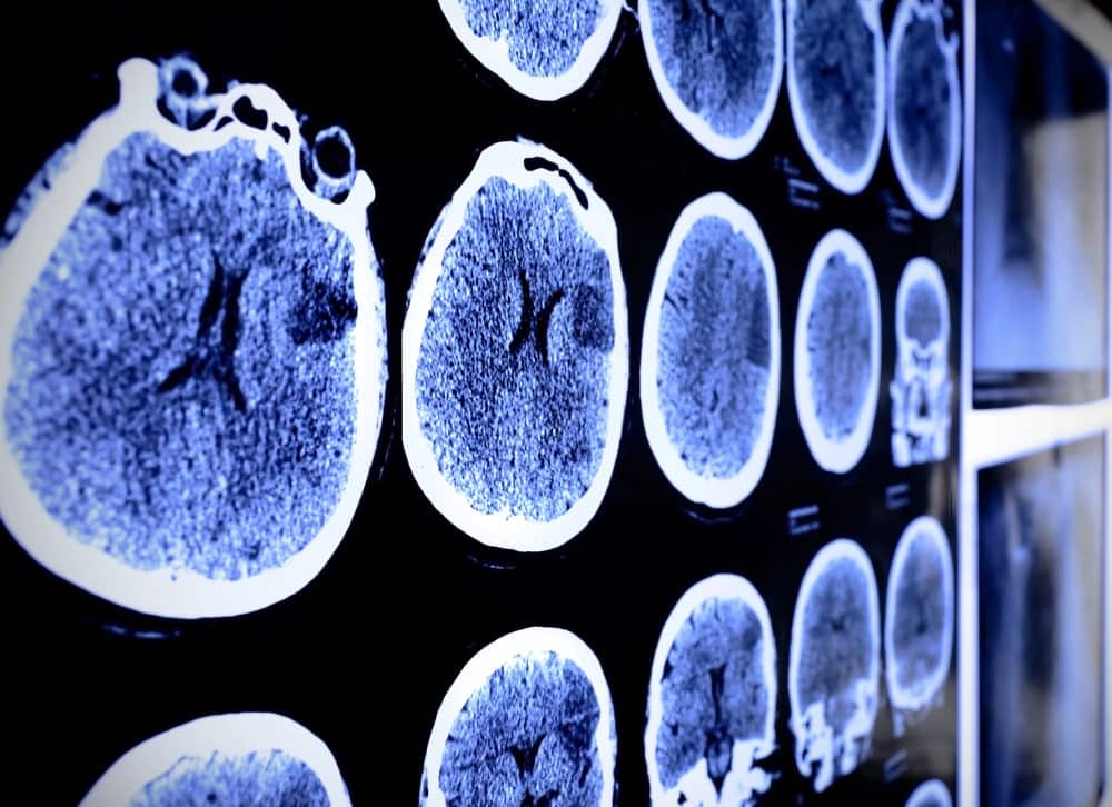 personal injury lawyer Roosevelt, NY